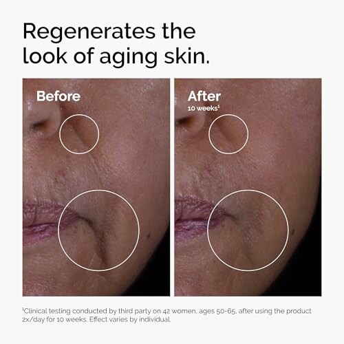 Comparison of skin before and after 10 weeks of treatment showing reduced aging signs.